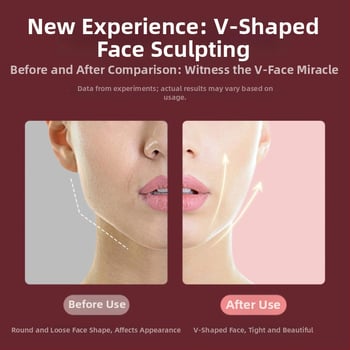 Vibracijski uređaj za oblikovanje lica, model hy49, ABS kućište, električni, CE/FCC/ROHS