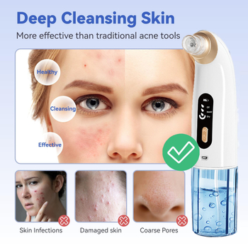 Uređaj za usisavanje crnih mitesa za lice, kućno čišćenje pora ultrazvučnom vibracijom, model Br-8825 (ultrazvučna vibracija; funkcija: mala mjehurići apsorbiraju crne mitese; 3 postavke)