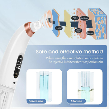 Uređaj za usisavanje crnih mitesa za lice, kućno čišćenje pora ultrazvučnom vibracijom, model Br-8825 (ultrazvučna vibracija; funkcija: mala mjehurići apsorbiraju crne mitese; 3 postavke)