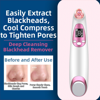 Dicai Ultragarsinis veido valymo įrenginys, modelis MRY21010 — juodųjų taškų absorcija, ABS korpusas