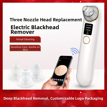 Vizualus juodųjų taškų šalinimo prietaisas — elektrinis suktukas, ABS korpusas, 3 pakopos, porų valymas