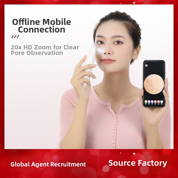 Vizualus juodųjų taškų šalinimo prietaisas — elektrinis suktukas, ABS korpusas, 3 pakopos, porų valymas