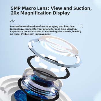 Vizualus juodųjų taškų šalinimo prietaisas — elektrinis suktukas, ABS korpusas, 3 pakopos, porų valymas