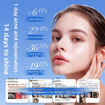 Photon šviesos terapijos grožio kaukė – LED šviesos terapija odos atjauninimui ir šviesinimui, 3 greičiai, įkrovimas, namų naudojimui