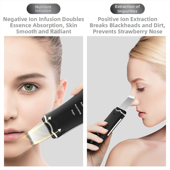 Ултразвуков апарат за красота за лице: почистване на лицето, избелване, повдигане, подмладяване на кожата, ултразвуков пилинг