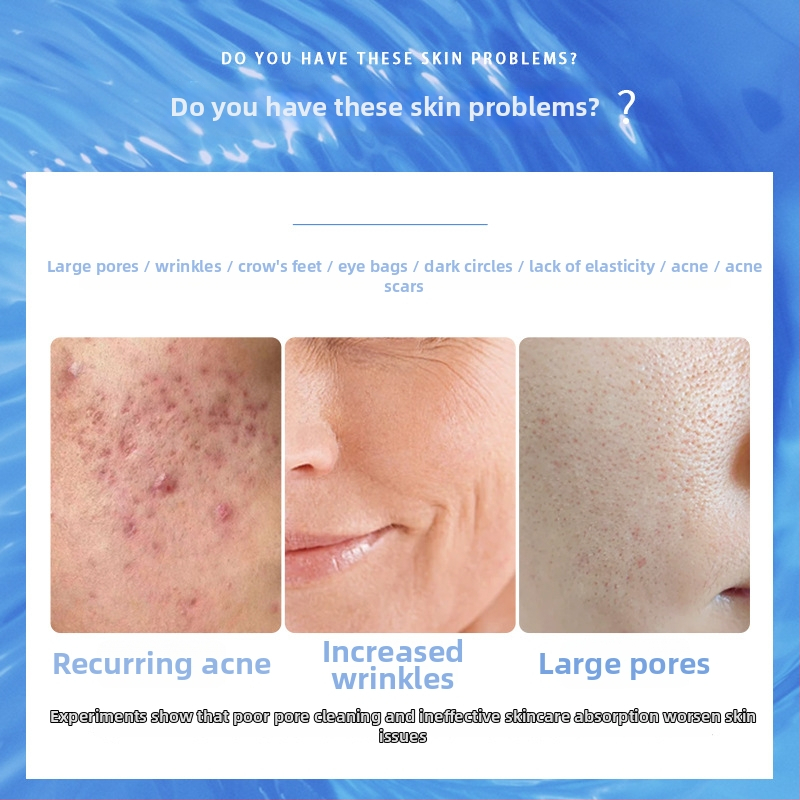 Feimeng kozmetikai készülék vörös–kék fény fototerápiával a tisztításhoz, fehérítéshez, a bőr megújításához és infravörös funkcióhoz; nem hordozható kereskedelmi szépségkészülék IPX3 vízállósággal.