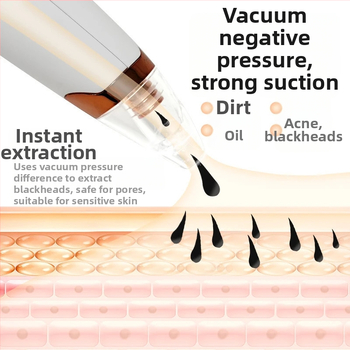 Juodųjų inkštirų siurbimo įrenginys, elektrinis namų kosmetikos įrankis, modelis 5678, 3 pakopų reguliavimas