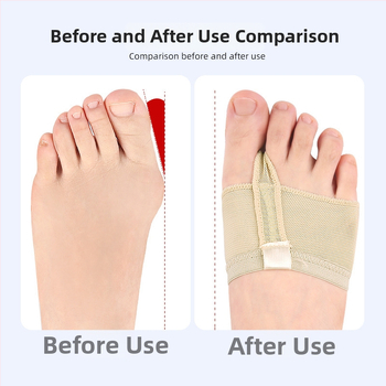 Προστατευτής ποδιού Belly Dance – πρόσθιο μαξιλαράκι για το μπροστινό μέρος του πέλματος, σόλα από ελαστικό πλέγμα μικροϊνών, κατάλληλος για μπαλέτο, γυμναστική και λατινικούς χορούς, όλες οι εποχές