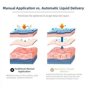 Dispozitiv pentru creșterea părului cu lumină de apă – aparat de înfrumusețare, stilou microcristal, baterie 2000–4000 mAh, IPX3, portabil