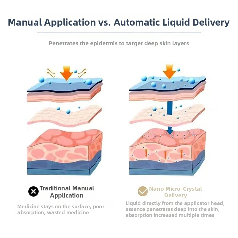 Ūdens gaismas matu augšanai – rokas darbs skaistumkopšanas ierīce ar mikrokristāla pildspalvu, 2000–4000 mAh akumulatoru, IPX3, pārnēsājama