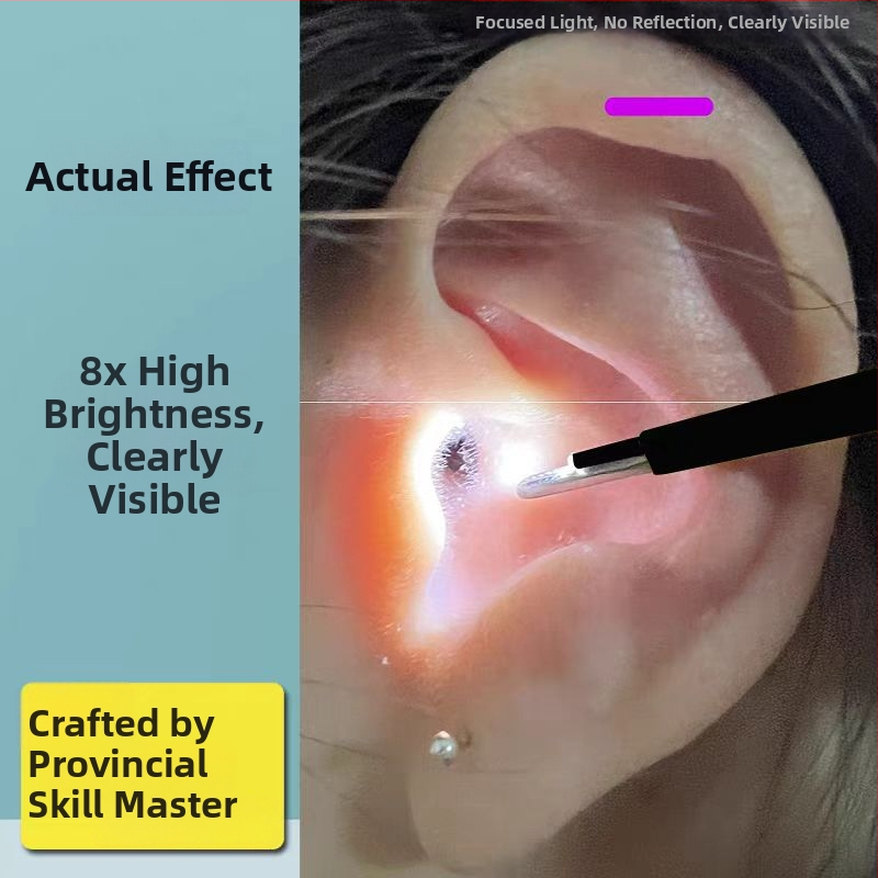 Gaismas auss tīrīšanas instruments — profesionāls instruments, zīmols Excellent Doctor