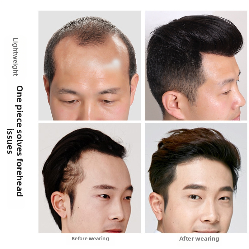 Vyrų plaukų įdėklas kaktai, nematoma plaukų linija, tikri plaukai viršugalvyje, trumpas ilgis, rankų audimas