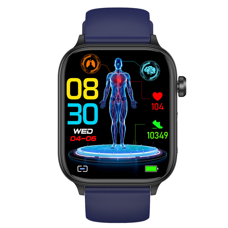 ET570 pametni sat s ECG, mjerenjem zasićenja krvi kisikom, otkucaja srca i krvnog tlaka, AMOLED zaslon