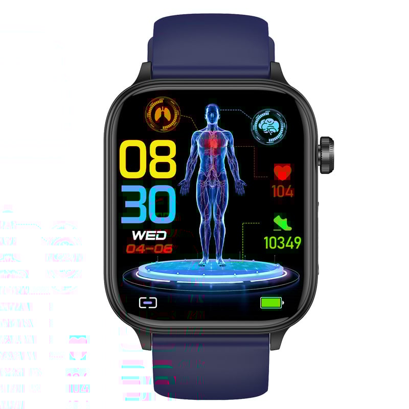 ET570 pametni sat s ECG, mjerenjem zasićenja krvi kisikom, otkucaja srca i krvnog tlaka, AMOLED zaslon