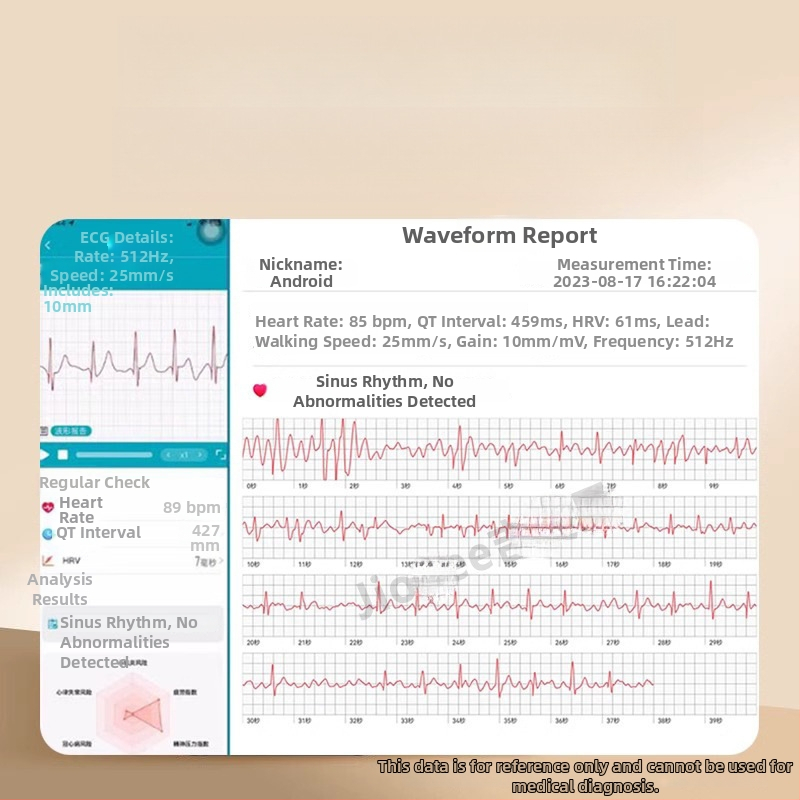 Медицински смарт часовник с Bluetooth разговори, ECG, измерване на кръвно налягане, пулс и мониторинг на здравето (липиди в кръвта и урикова киселина)