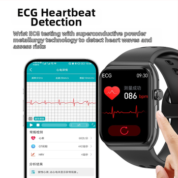 BK01 sportski pametni sat s Bluetooth pozivima, EKG, mjerenje krvnog tlaka, zasićenost kisikom u krvi i srčani ritam