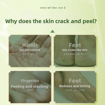 Avokado aliejaus kremas įtrūkimų odai - Dr.Martinson, tekstūra pasta, vaisinis kvapas, galiojimo laikas 2 metai, kūno priežiūros rinkinys