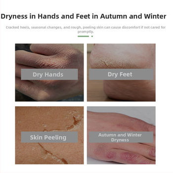 Σετ περιποίησης σώματος - patches με φρουτώδες άρωμα για χέρια και πόδια, καθολική χρήση, κανονικές προδιαγραφές, μάρκα Jinke