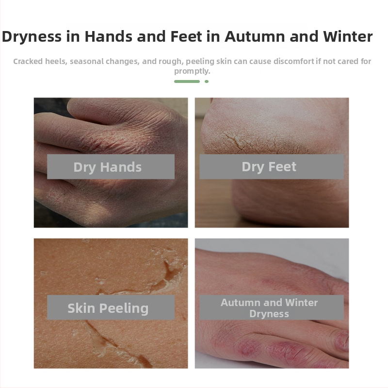 Σετ περιποίησης σώματος - patches με φρουτώδες άρωμα για χέρια και πόδια, καθολική χρήση, κανονικές προδιαγραφές, μάρκα Jinke