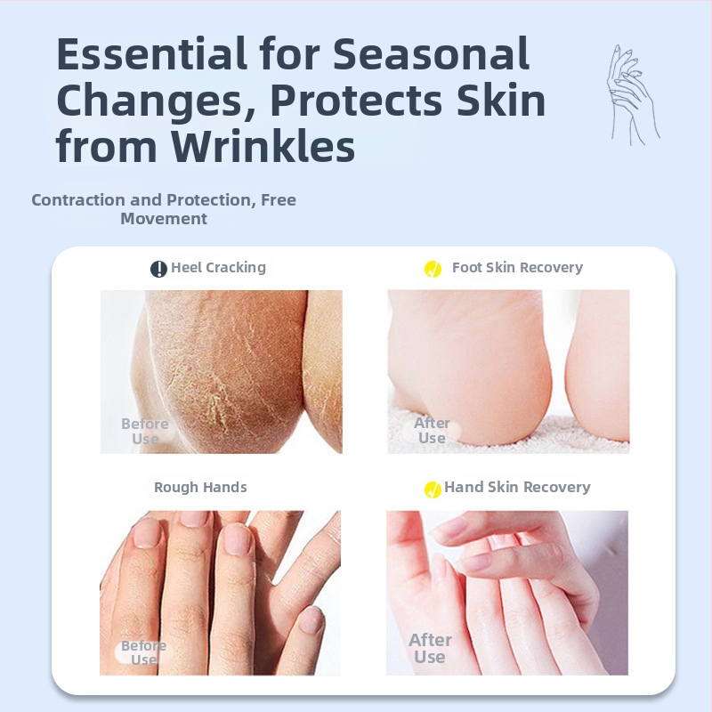 Lábpatchek / lábmaszk – növényen alapú kenőcs száraz bőrre, cellulit enyhítés, SPF 30+