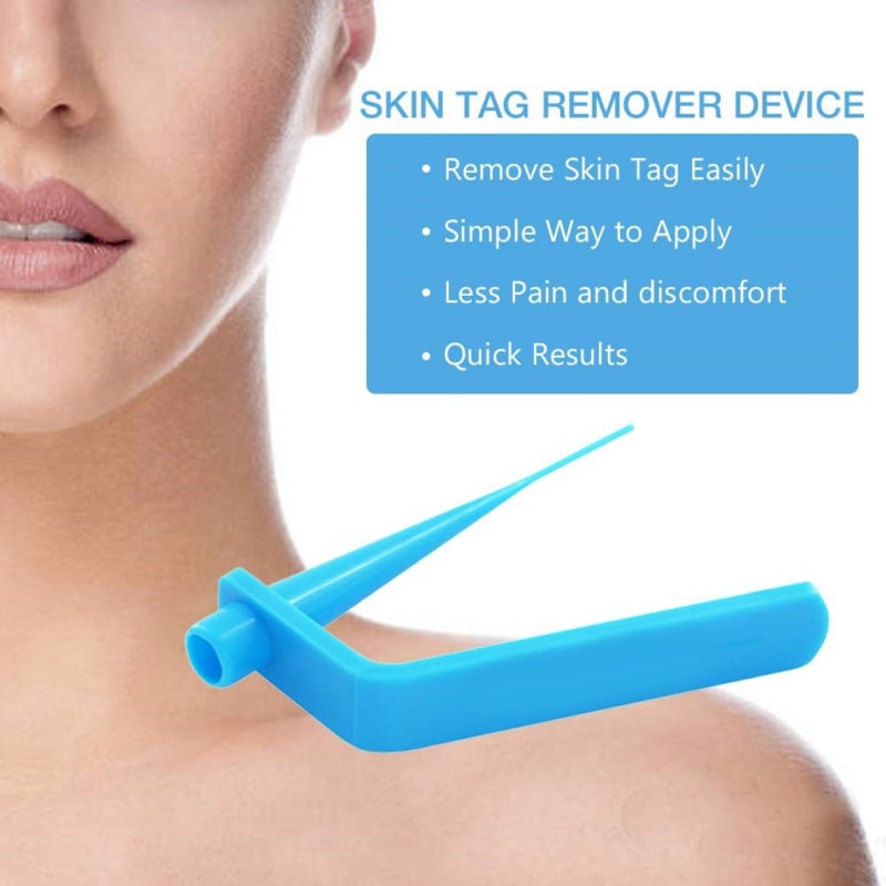 Bőrtagok és szemölcsök eltávolítására szolgáló eszközök készlet — Eredet: Guangzhou; Márka: Skin Tag Removal Tool; Import: Nem