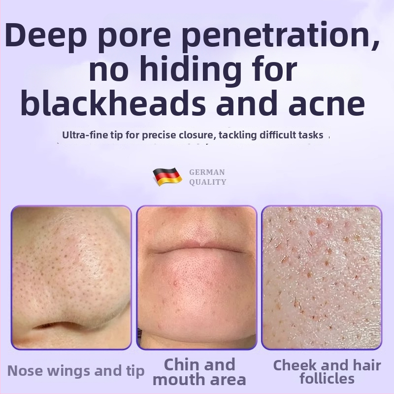 Profesionálny kozmetický nástroj z nerezu: klips na bunkové akné ihly, delfínový klip, pôvod Yangjiang, 5-ročná životnosť