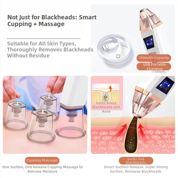 Električni uređaj za čišćenje pora lica s vakuumskim usisavanjem i toplim/hladnim režimom, model SY-085, CE potvrda, brenda Suxiaomei, 4 brzine