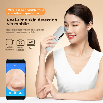 Električni rotirajući alat za uklanjanje komedona – AJL001, ABS kućište, treća brzina, uklanja komedone i akne