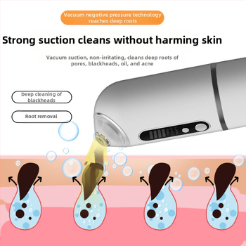 Električni rotirajući alat za uklanjanje komedona – AJL001, ABS kućište, treća brzina, uklanja komedone i akne