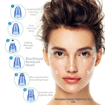 Uređaj za uklanjanje crnih točaka – vakuumski uređaj, model SY, Beautiful Beauty; usisava crne točkice, čisti pore, upija masnoću; 5 brzina