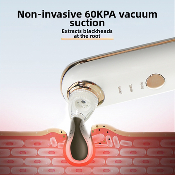 Hordozható pórustisztító készülék 60 kPa-s szívóerővel, 3 sebesség, beépített 800-1000 mAh akkumulátor, otthoni használatra szánt akne eltávolító