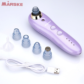 Ultrazvučni uređaj za uklanjanje crnih točaka, čišćenje pora, prijenosno, ugrađena baterija 500–800 mAh, IPX5 vodootporan, za kućnu upotrebu