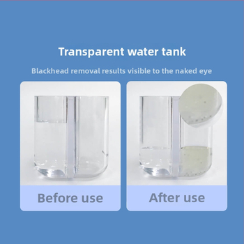 DOCO ultrahangos pórustisztító kis buboréktechnológiával, 4 fokozat