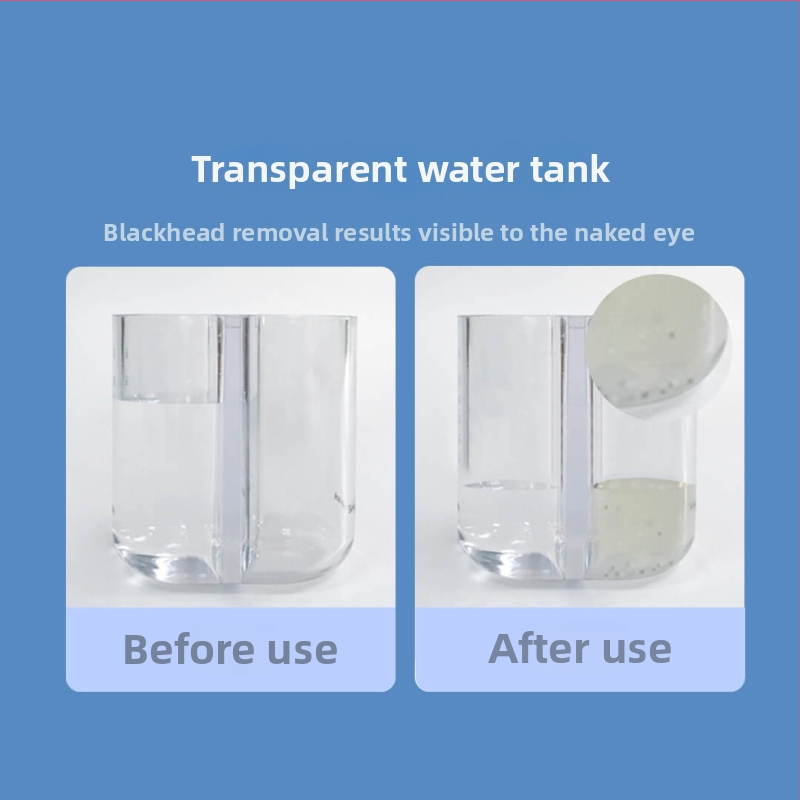 DOCO ultrahangos pórustisztító kis buboréktechnológiával, 4 fokozat