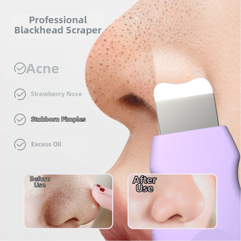 Mini špachtľa na čierne body s silikónovou čistiacou kefou na tvár – model J501, fyzická adsorpcia, ručné ovládanie, konštrukcia zo silikónu a nerezovej ocele, hmotnosť 35 g