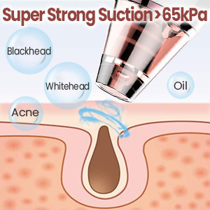 Устройство за премахване на черни точки с електрическо въртене, модел effr435, 3 настройки, ABS+PC корпус