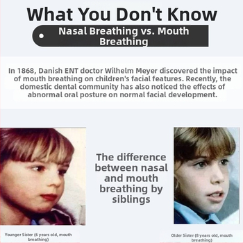 Szájzáró légzéskorrigáló, PE anyag, Cartoon stílus, Légcsatorna korrekció, Testreszabás nélkül