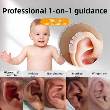 Corector de auriculă pentru sugari și copii mici, DIFKING 25A, lansare în primăvara 2026, fără certificare