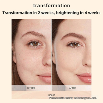 Xin Phil arckészülék – maszk a ráncok ellen infravörös és színes fény terápia, hordozható, IPX3 vízálló.