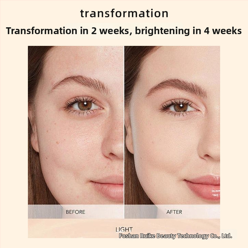 Xin Phil arckészülék – maszk a ráncok ellen infravörös és színes fény terápia, hordozható, IPX3 vízálló.