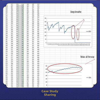GSR сензор за кожа — измерване на съпротивление и проводимост на кожата, комплект за кожни измервания, анализ на реакцията, разработка на микроконтролер