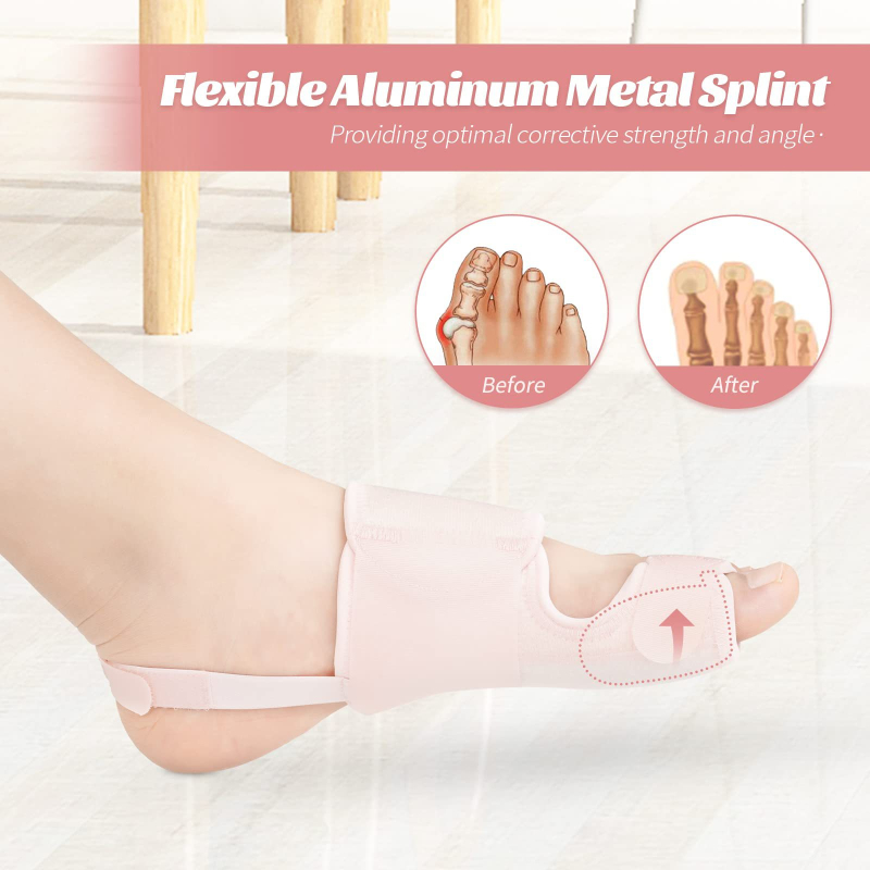 Korektor za veliki palac s aluminijskim štitnikom – Model B-035, Toe Corrector serija, dnevna i noćna uporaba, sve sezone