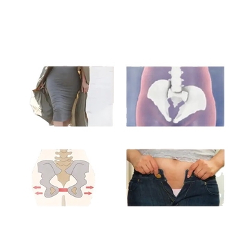 Naduvani zdjel pelvis za trudnice s podrškom i rehabilitacijskom funkcijom, model V posture 17, šifra proizvoda F4260, namijenjeno kukovima i zdjelici