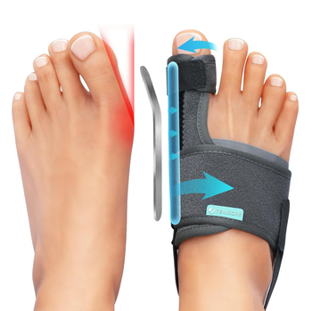 Hallux valgus ortoza s odjeljivačem prsta i aluminijskom trakom podrškom | Model 24-M-002 | Prozračan materijal + Velcro