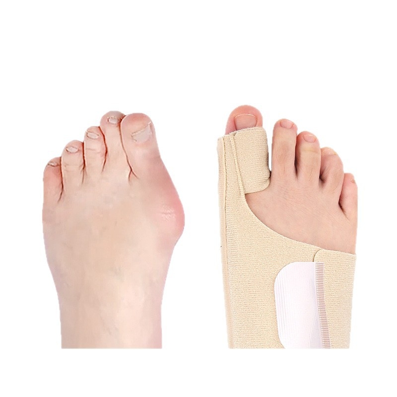 Remen za fiksiranje prsta za hallux valgus; razdjeljiva prsta za preklapajuće prste; mekani ortopedski pojas za dnevnu i noćnu upotrebu; materijal: OK tkanina