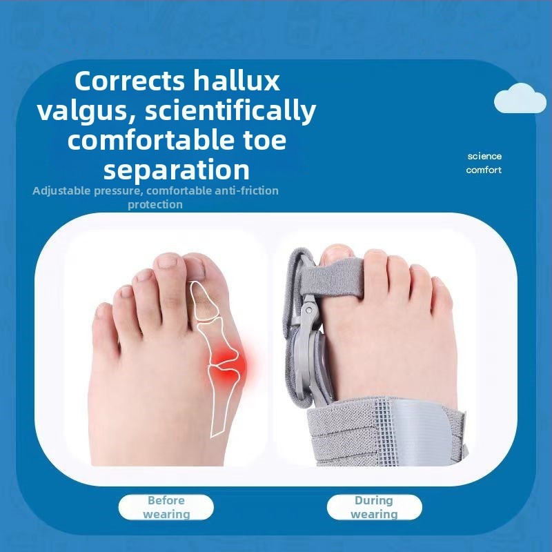 Ortóza hallux valgus palca, nastaviteľná, unisex, nočné použitie, TPR materiál