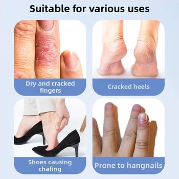 Prozračni flaster za ispucalu kožu – netkani materijal, anti-pucanje, univerzalna namjena, rok trajanja 24 mjeseci