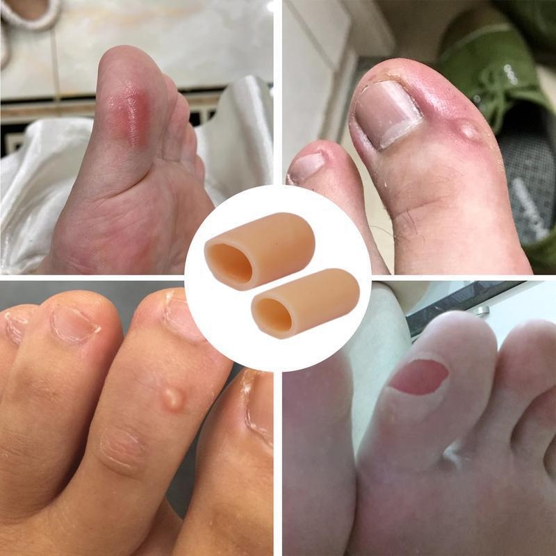 N5011 Szilikon cipőhosszabbító nagy védőfedővel textilecipőkhöz