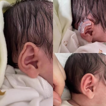 Ушно коригиращо устройство за новородени и възрастни, лепенки за ушна хрущял и поддръжка зад ухото за изпъкнали уши — Color industry; Модел: See description; Време на пазара: See description; Сертификация: Няма