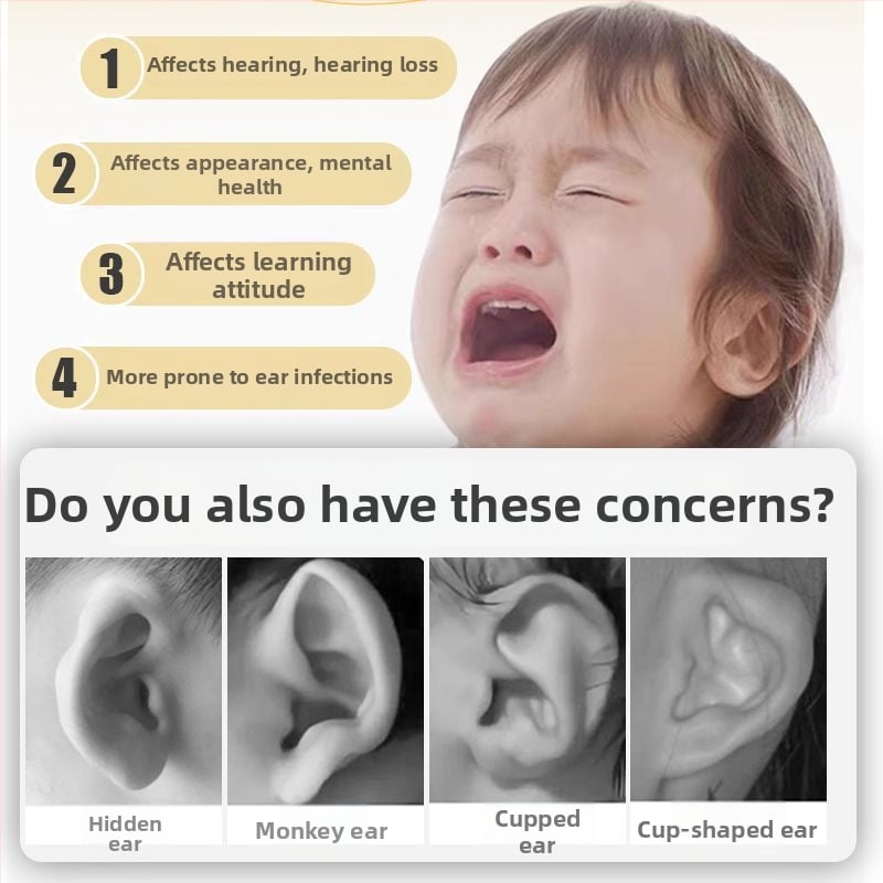 Ушно коригиращо устройство за новородени и възрастни, лепенки за ушна хрущял и поддръжка зад ухото за изпъкнали уши — Color industry; Модел: See description; Време на пазара: See description; Сертификация: Няма